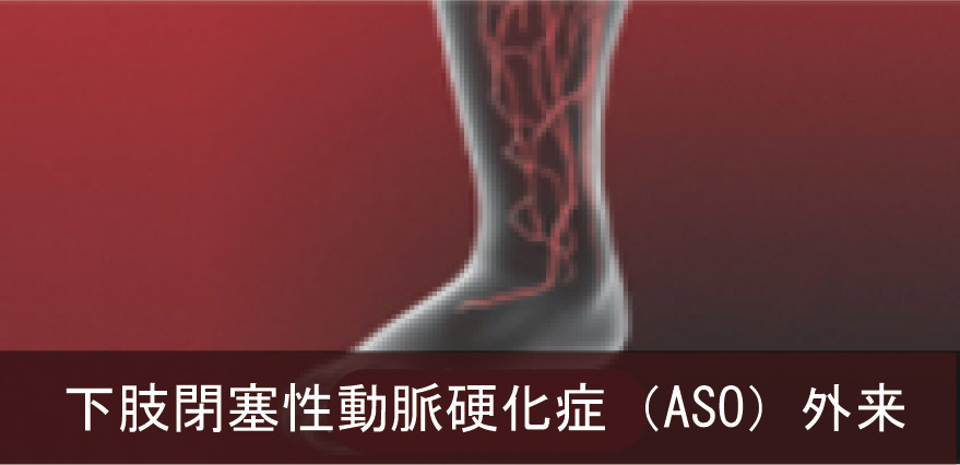 下肢閉塞性動脈硬化症（ASO）外来